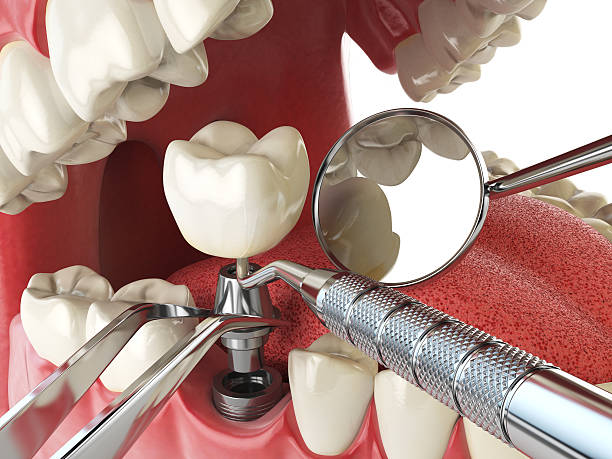 Best Orthodontic Emergency Dentist in North Haverhill, NH